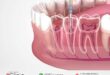 Best Female Dentist in Karachi | Expert Dental Implants for Smile